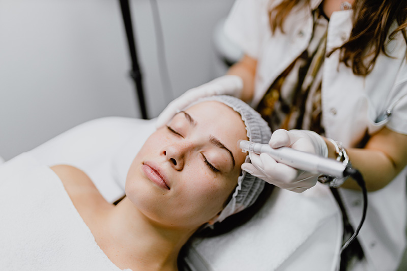Woman receiving microneedling
