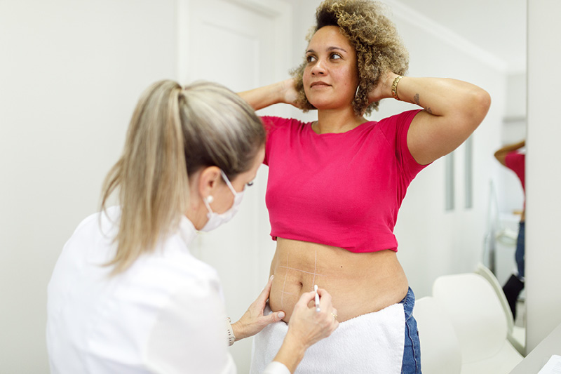 Panniculectomy vs. abdominoplasty: What’s the difference? 